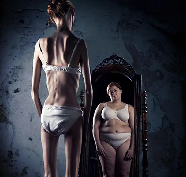 anorexia2